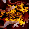 Novel coronavirus SARS-CoV-2
