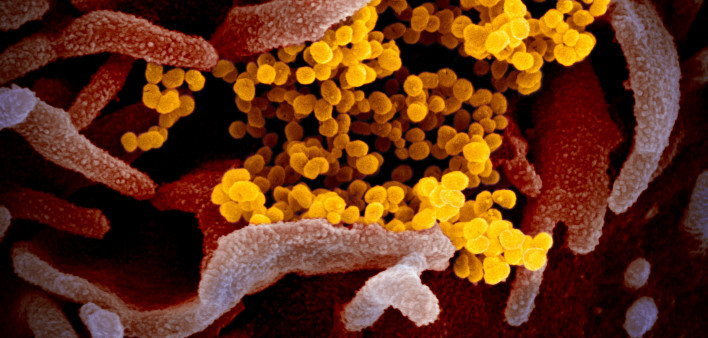 Novel coronavirus SARS-CoV-2