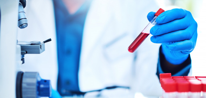 Closeup shot of a scientist analyzing samples in a laboratory