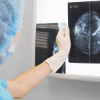 Mammogram image