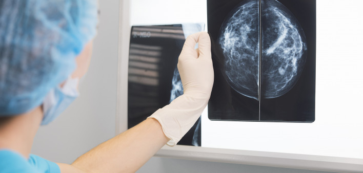 Mammogram image
