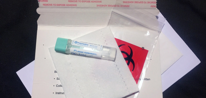 FIT test, colon cancer screening