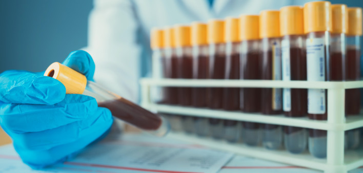 Blood vials in laboratory scientist