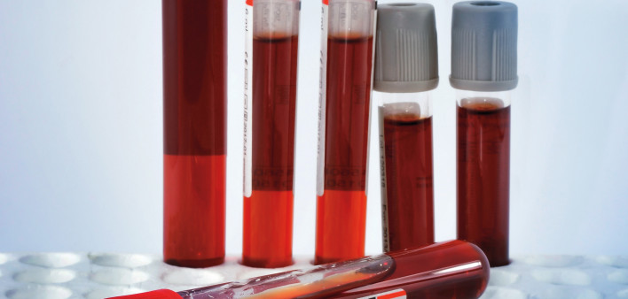 red blood in test tubes in tray