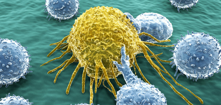 T-lymphocytes attack a migrating cancer cell.