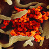 Novel coronavirus SARS-CoV-2