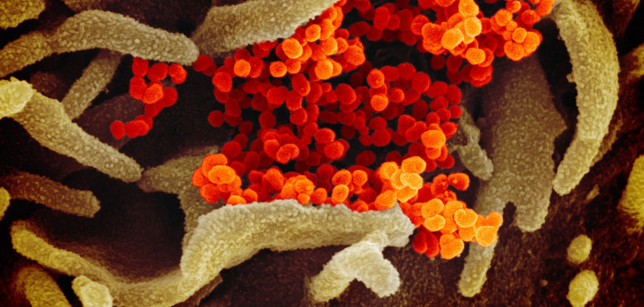 Novel coronavirus SARS-CoV-2