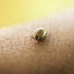 Tick crawling on human skin