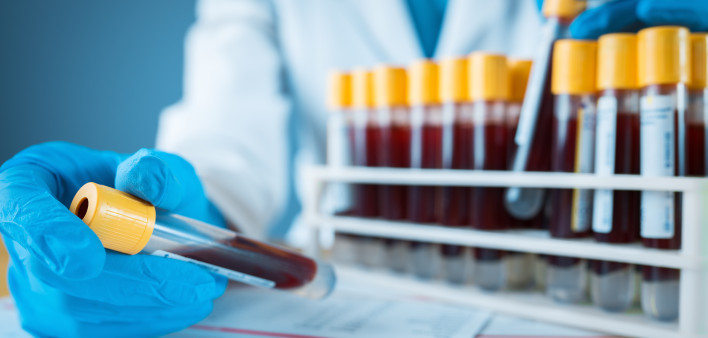 Laboratory result with blood tubes