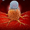 Chimeric antigen receptor T-cell (CAR-T) therapy