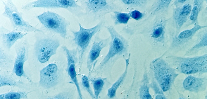 HeLa cervical cancer cells, stained with Coomassie blue, under microscope.