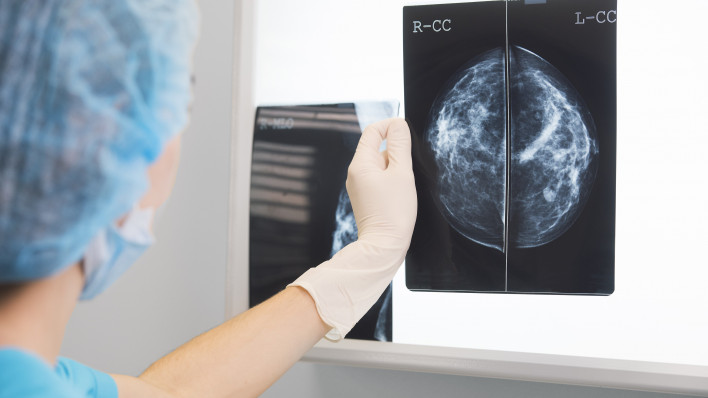 Mammogram image