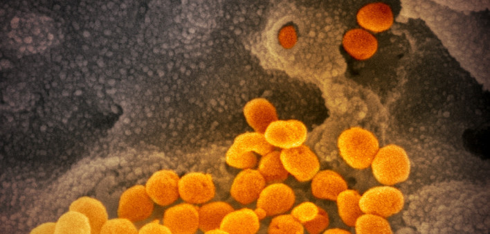 Novel coronavirus SARS-CoV-2