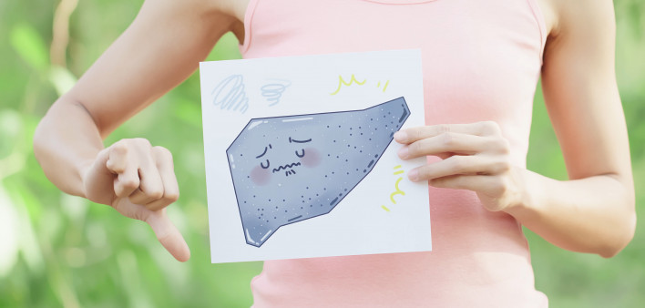 Woman with cirrhosis liver