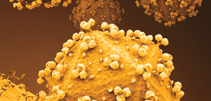 HIV attaching to cell