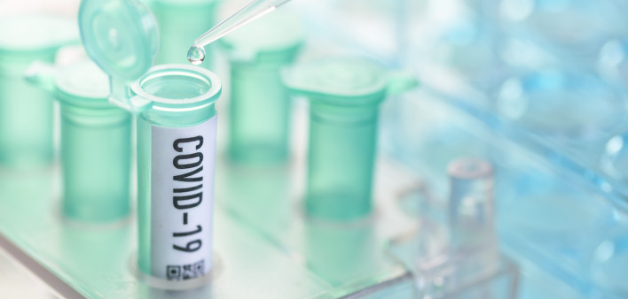 vial with pipette in laboratory