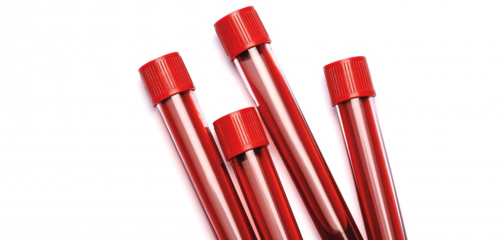 vials of blood with red tops
