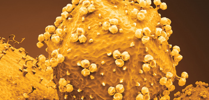 HIV attaching to cell