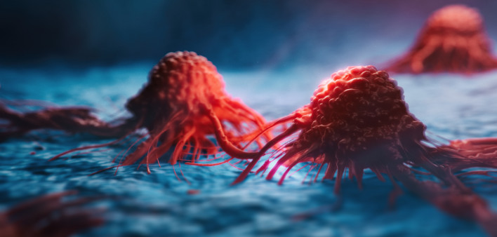 cancer cells