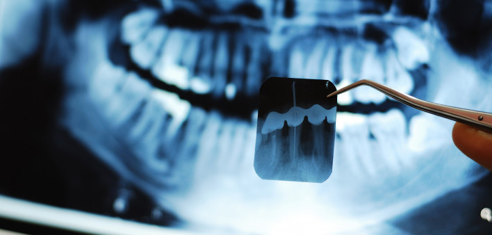 Dental X-Ray stock
