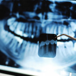 Dental X-Ray stock