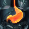 esophagus, throat, stomach, gastric, digestive tract