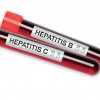 Hepatitis C Hepatitis B blood test tubes