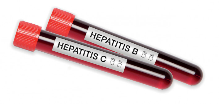 Hepatitis C Hepatitis B blood test tubes