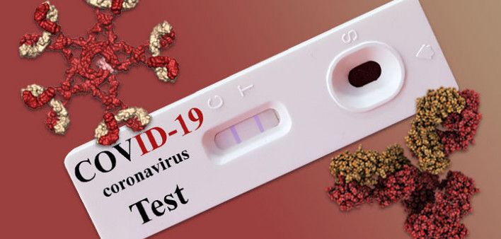 COVID-19 antibody test