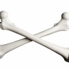 Bones