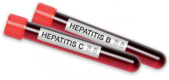 Hepatitis C Hepatitis B blood test tubes