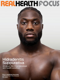 Real Health Focus Skin Summer 2021Hidradenitis Suppurativa Jonathan Kumuteo