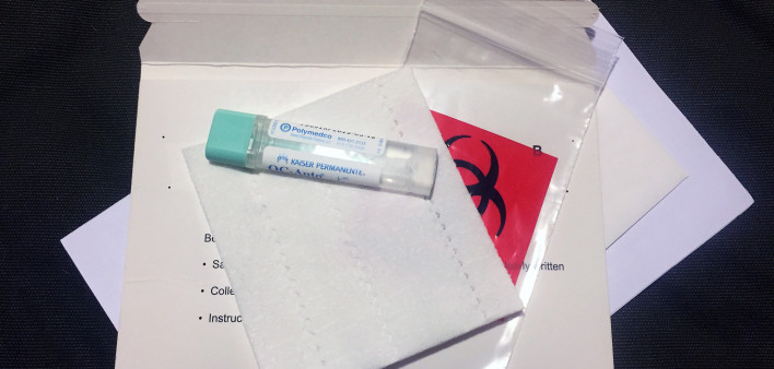 FIT test, colon cancer screening