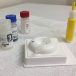 HIV Antibody Testing Kit  A testing kit used to detect HIV antibodies rapidly in human blood