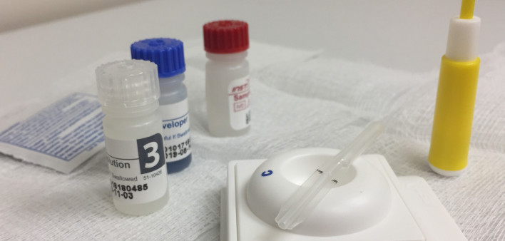 HIV Antibody Testing Kit  A testing kit used to detect HIV antibodies rapidly in human blood