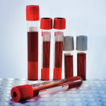 red blood in test tubes in tray