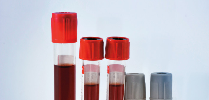 red blood in test tubes in tray