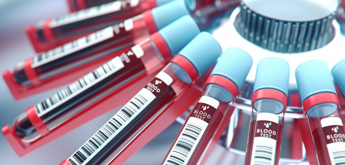 Lab equipment centrifuging blood