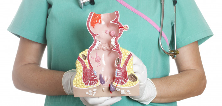 Anatomical model of rectum and anus