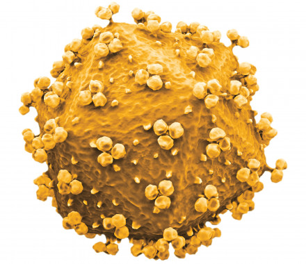 HIV Virus