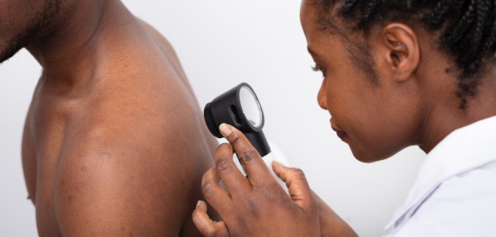skin cancer screening black man
