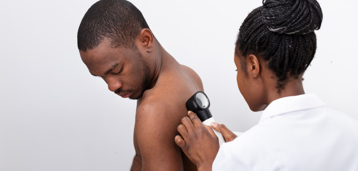 skin cancer screening black man