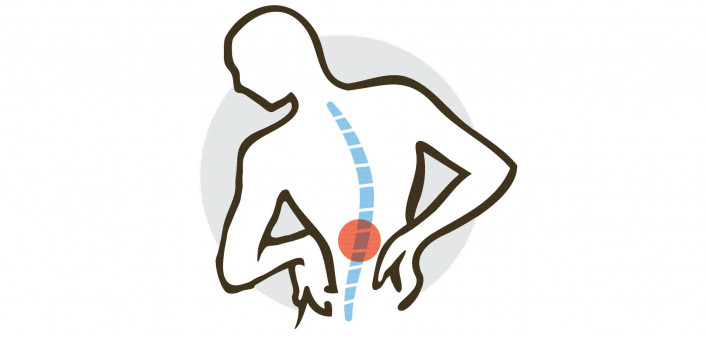 illustration of back pain