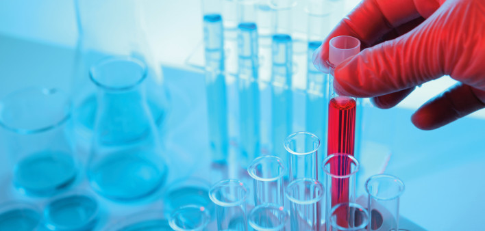 vials and beakers test tubes red liguid lab