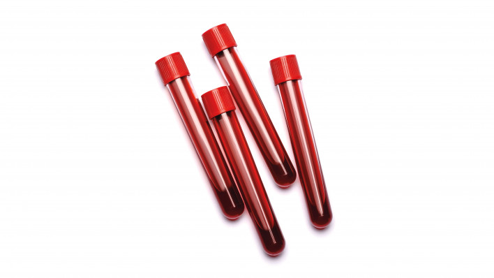 vials of blood with red tops