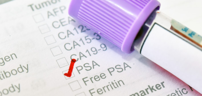Blood sample tube with lab requisition form for PSA test, prostate cancer diagnosis