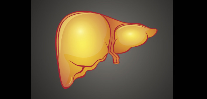 fatty liver