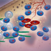 Multiple myeloma cells