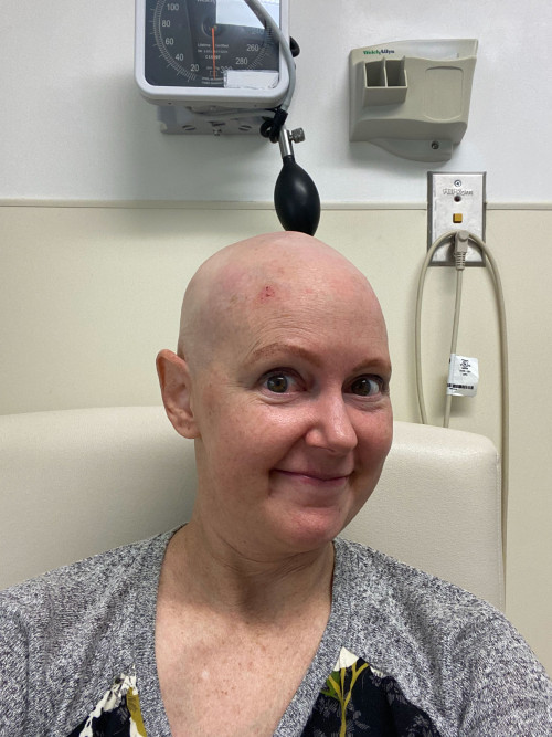 Erin Cronican undergoing her own chemotherapy