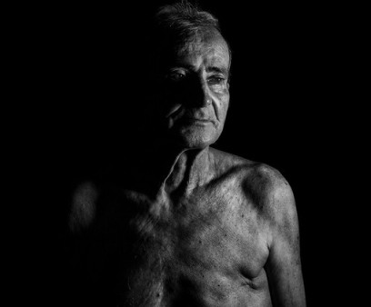 Jose Ferreira, male breast cancer